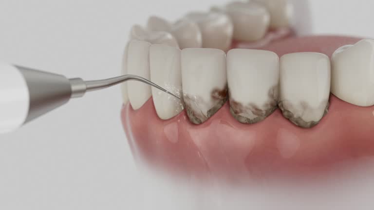 Reliable Dental Implants contractor in Hartland, WI by Smile Center Dentistry